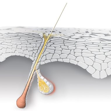 Micro-inflammation in the skin