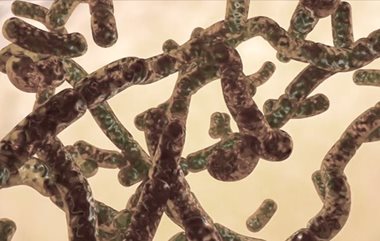 Acne caused by bacteria on the skin
