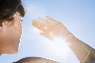 Post-inflammatory hyperpigmentation and the sun