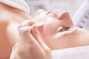 PIH cream: chemical peels