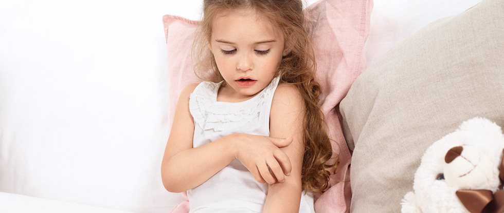 Infant Eczema