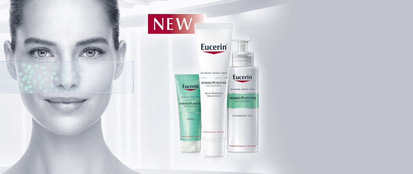 Woman with facial acne prone skin