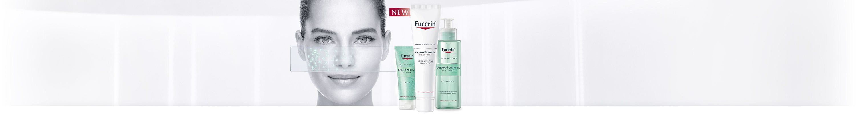 Woman with facial acne prone skin